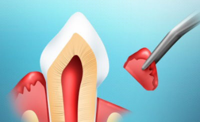 Сколько стоит лечение зуба во владивостоке